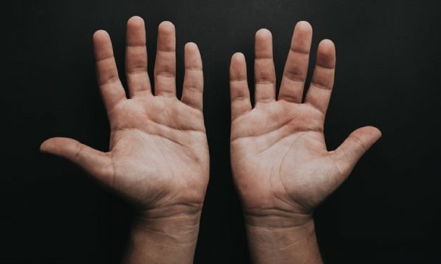 Surprise Rheumatoid Arthritis Discovery Points to New Treatment for Joint Inflammation